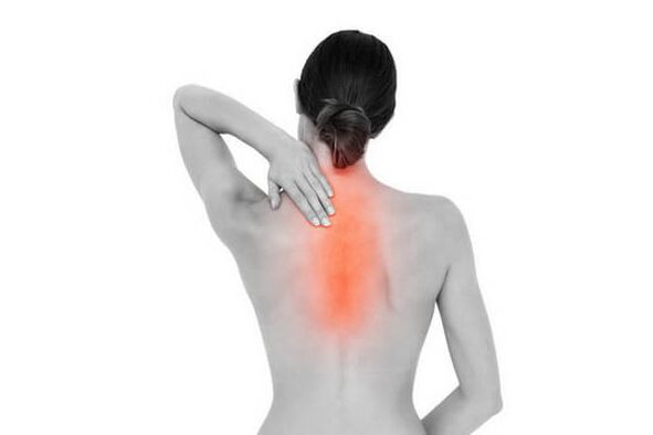 Muguras osteohondroze